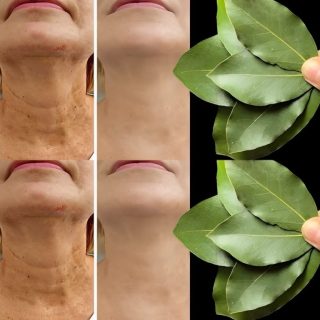 Liść laurowy jest 100 000 razy silniejszy niż botoks? | Naturalny środek na zmarszczki nawet w wieku 70 lat!