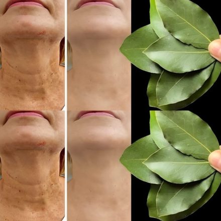 Liść laurowy jest 100 000 razy silniejszy niż botoks? | Naturalny środek na zmarszczki nawet w wieku 70 lat!