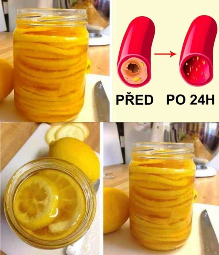 Cudowna, stara receptura na oczyszczenie naczyń krwionośnych i wątroby, którą stosowały nasze babcie