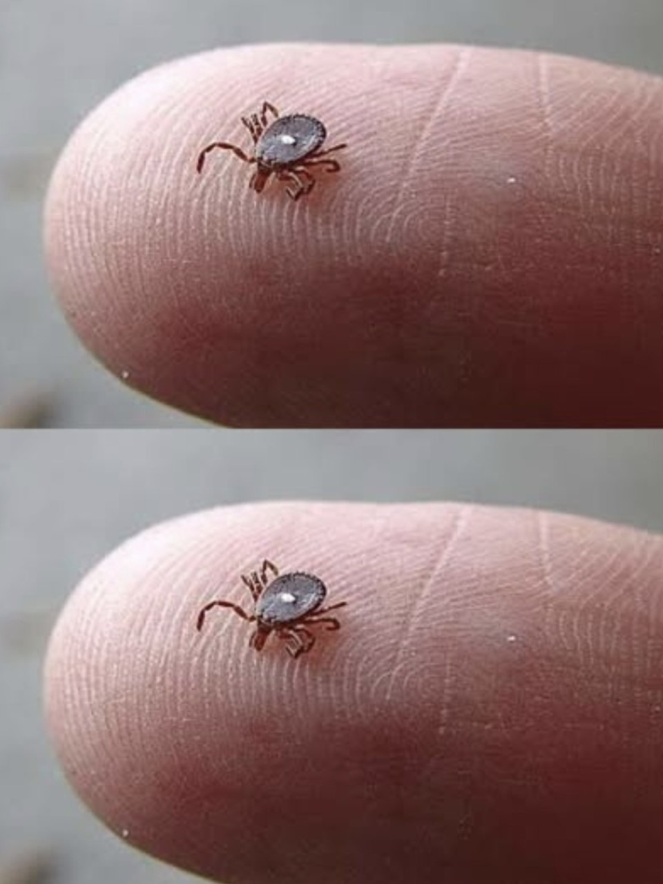 Czy ktoś wie, co to jest? Znalazłem to pełzające po nodze mojego syna po spacerze w lesie. Wyglądało jak kleszcz… ale ta dziwna biała plamka mnie wystraszyła. Trochę się boję. Czy ktoś kiedyś widział coś takiego?